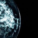 Cancer detection through NHS AI surpasses human capabilities, identifying tiny cancers missed by doctors